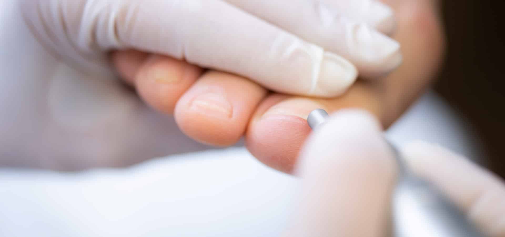 Medizinische Fußpflege und Podologie: Der Ratgeber für gesunde Füße